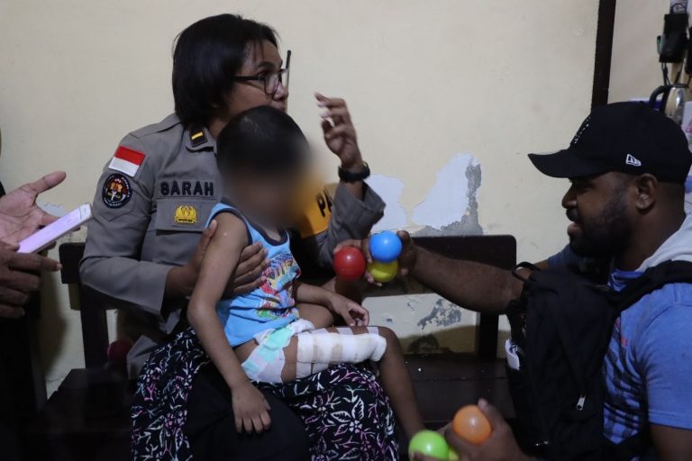 Seorang ayah tega aniaya anak kandungnya hingga patah kaki